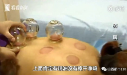 拔火罐视频,传统中医养生秘技大揭秘